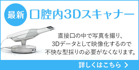 3Dスキャナー